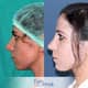 Slider image (3) Assoc. Prof. Fatih Irmak Aesthetic and Plastic Surgery Clinic